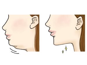 宇治市 歯医者 double chin なかむら歯科医院