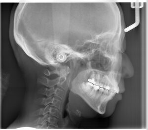 宇治市 歯医者 0007_KT_ LA_20240524 なかむら歯科医院
