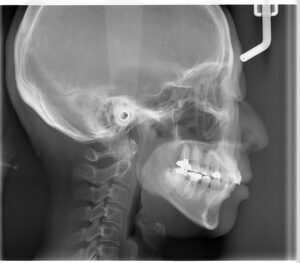 宇治市 歯医者 0007_KT_ LA_20241206 なかむら歯科医院