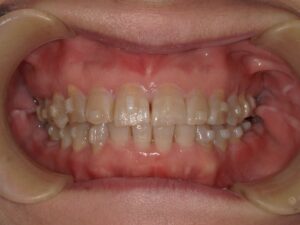 宇治市 歯医者 0007_KT_Oral front_20241206 なかむら歯科医院