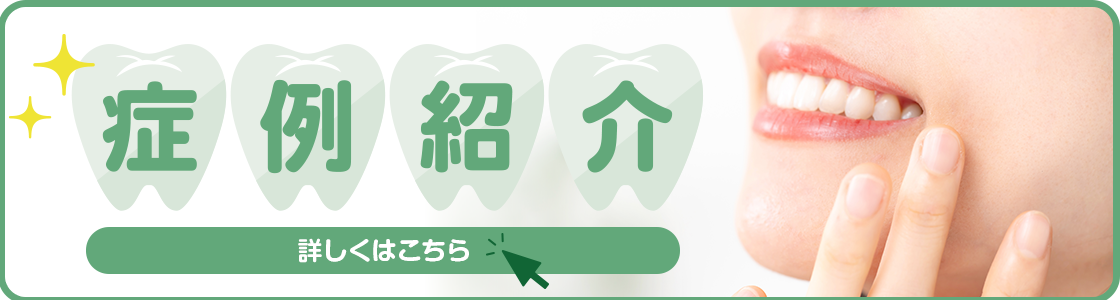 なかむら歯科医院 症例紹介