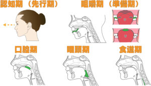 宇治市　歯医者　swallowing　なかむら歯科医院