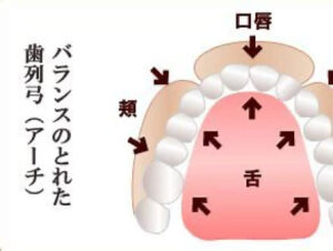宇治市　歯医者　tongue pressure　なかむら歯科医院